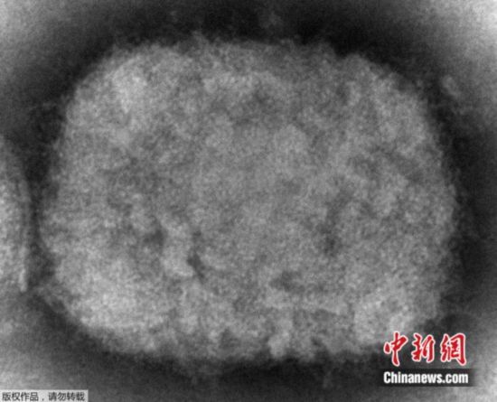 資料圖：美國疾病控制和預(yù)防中心(CDC)提供的2003年電子顯微鏡圖像顯示了一種猴痘病毒粒子。